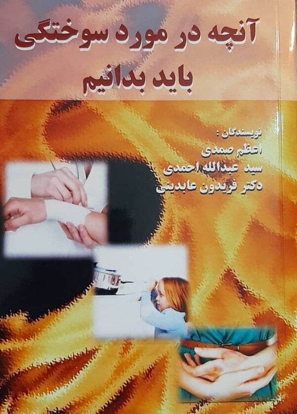 سوختگی